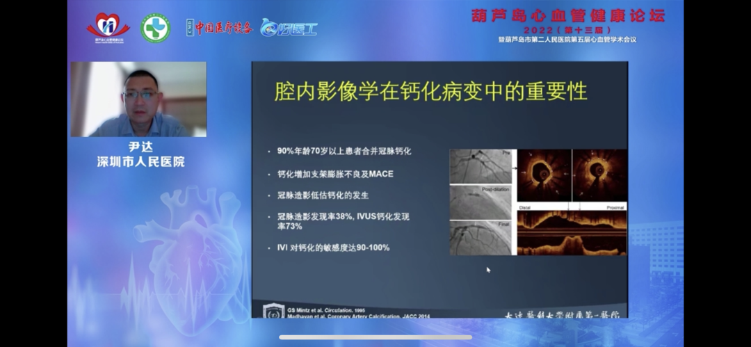 葫蘆島心血管健康論壇?2022｜創(chuàng)新驅(qū)動發(fā)展，不斷提升心血管疾病救治能力(圖11)